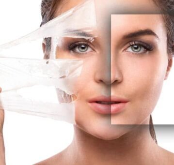 good-regimen-chemical-peel
